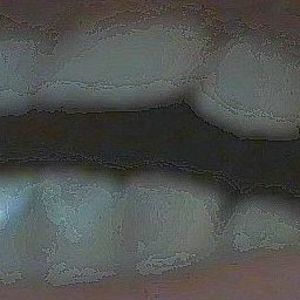 Meet your Posher, Bobby